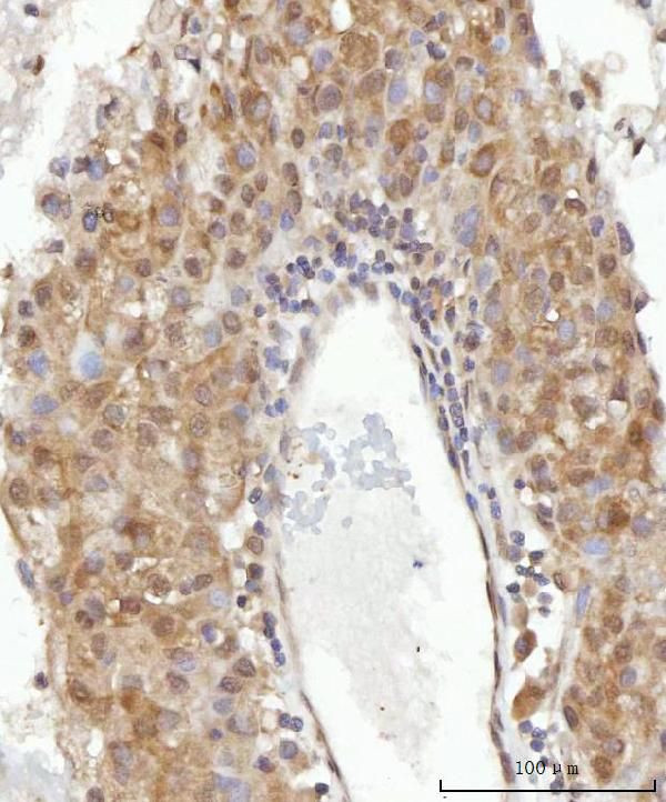 CEP250 Antibody in Immunohistochemistry (Paraffin) (IHC (P))