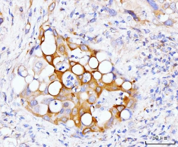 GSPT1/2 Antibody in Immunohistochemistry (Paraffin) (IHC (P))