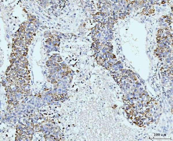 GSPT1/2 Antibody in Immunohistochemistry (Paraffin) (IHC (P))