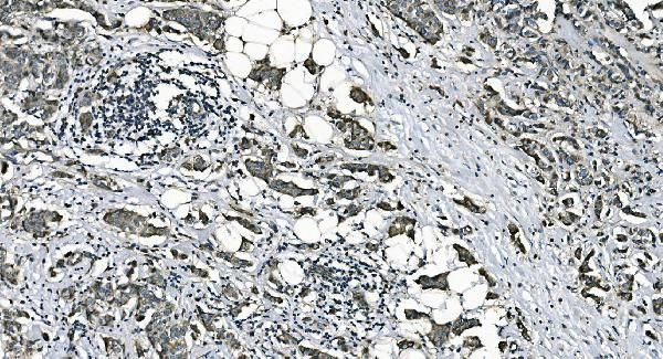 DNAJC10 Antibody in Immunohistochemistry (Paraffin) (IHC (P))