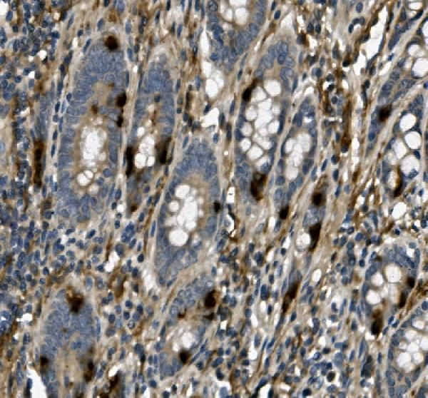 USP44 Antibody in Immunohistochemistry (Paraffin) (IHC (P))