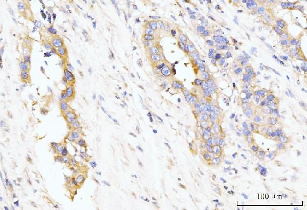 LAR4B Antibody in Immunohistochemistry (Paraffin) (IHC (P))