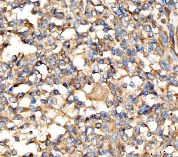 AP2A2 Antibody in Immunohistochemistry (Paraffin) (IHC (P))