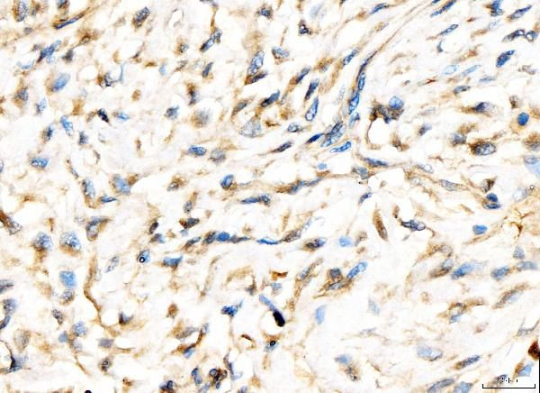 AP2A2 Antibody in Immunohistochemistry (Paraffin) (IHC (P))