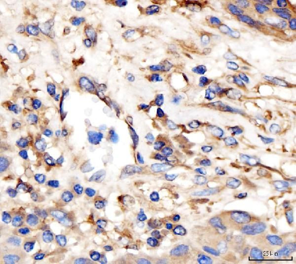 AP2A2 Antibody in Immunohistochemistry (Paraffin) (IHC (P))