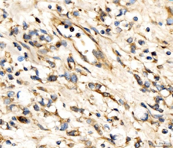 AP2A2 Antibody in Immunohistochemistry (Paraffin) (IHC (P))