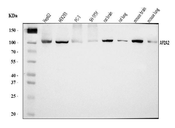 AP2A2 Antibody in Western Blot (WB)