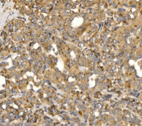 MLXIP Antibody in Immunohistochemistry (Paraffin) (IHC (P))