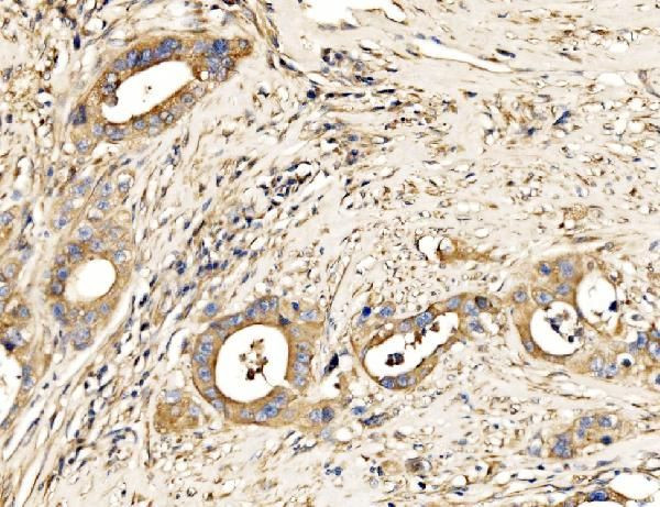 MLXIP Antibody in Immunohistochemistry (Paraffin) (IHC (P))