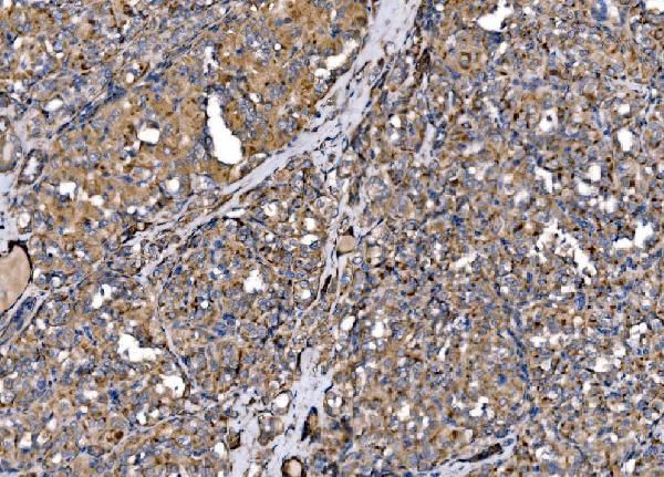 MLXIP Antibody in Immunohistochemistry (Paraffin) (IHC (P))