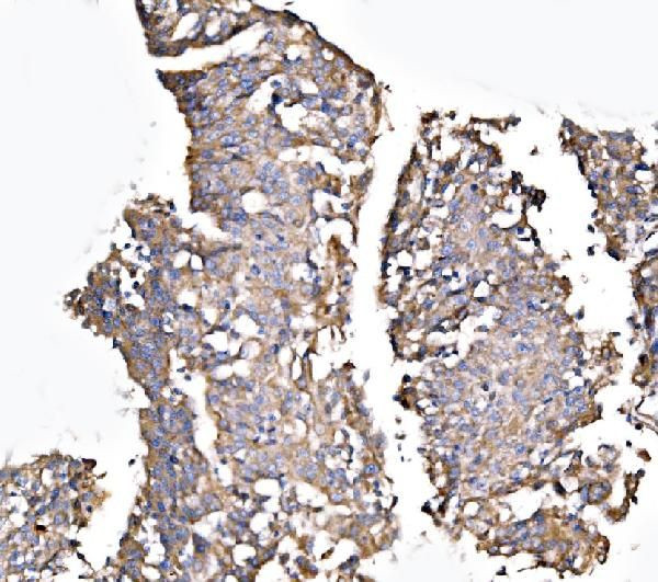 MLXIP Antibody in Immunohistochemistry (Paraffin) (IHC (P))