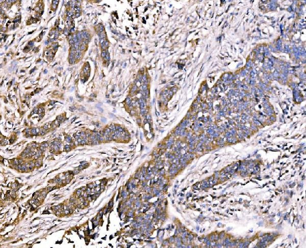 MLXIP Antibody in Immunohistochemistry (Paraffin) (IHC (P))