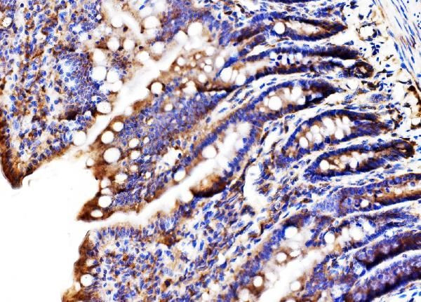 MLXIP Antibody in Immunohistochemistry (Paraffin) (IHC (P))