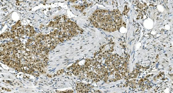 LSM7 Antibody in Immunohistochemistry (Paraffin) (IHC (P))