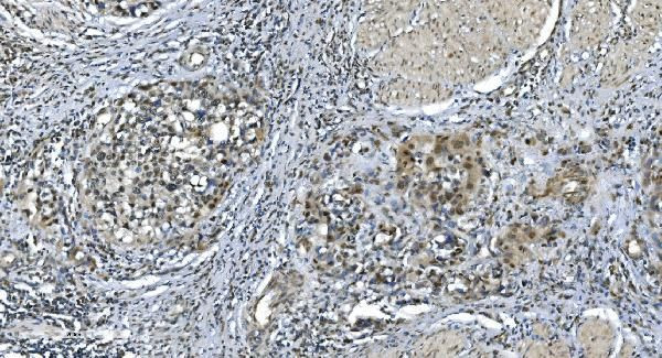 LSM7 Antibody in Immunohistochemistry (Paraffin) (IHC (P))