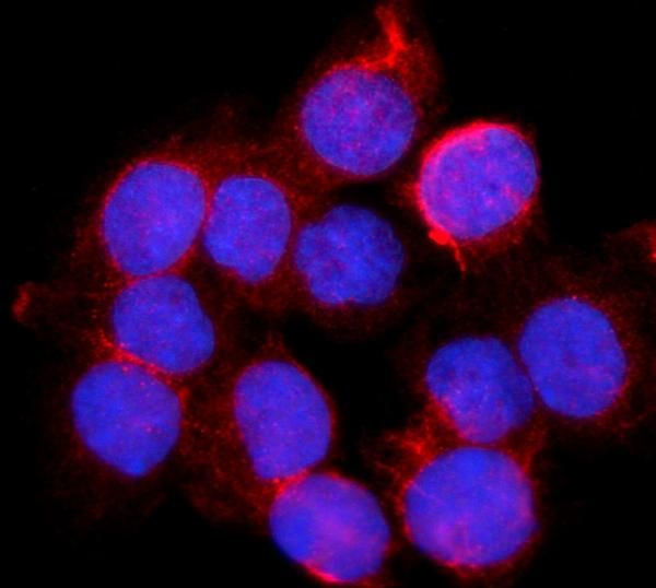 BDH1 Antibody in Immunocytochemistry (ICC/IF)