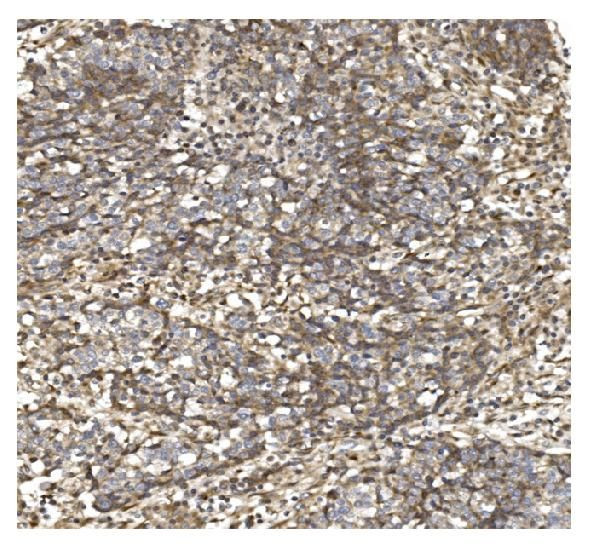 BDH1 Antibody in Immunohistochemistry (Paraffin) (IHC (P))