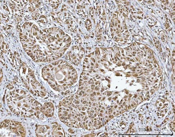 RG9MTD1 Antibody in Immunohistochemistry (Paraffin) (IHC (P))