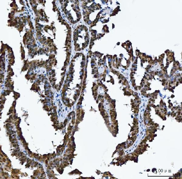 RG9MTD1 Antibody in Immunohistochemistry (Paraffin) (IHC (P))