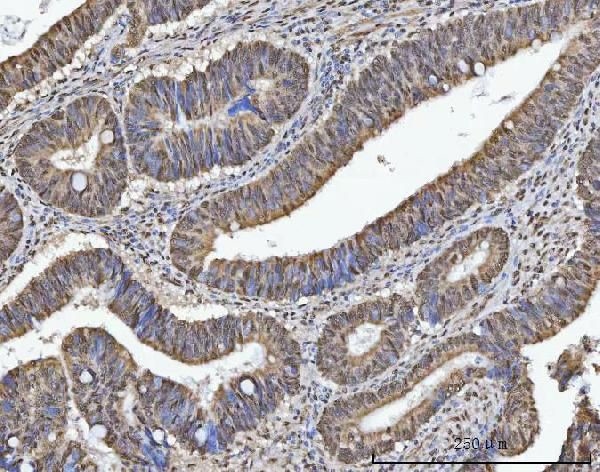 RG9MTD1 Antibody in Immunohistochemistry (Paraffin) (IHC (P))