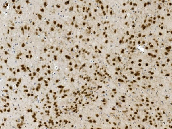 Nova-2 Antibody in Immunohistochemistry (Paraffin) (IHC (P))