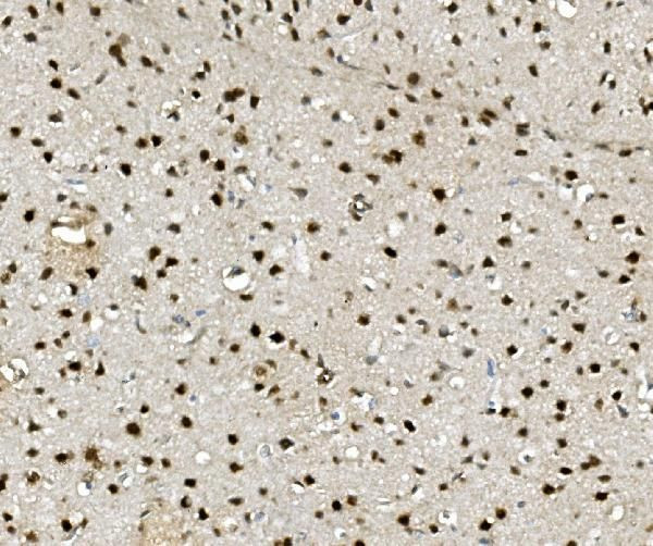 Nova-2 Antibody in Immunohistochemistry (Paraffin) (IHC (P))