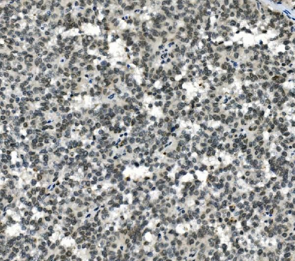 HOXD11 Antibody in Immunohistochemistry (Paraffin) (IHC (P))