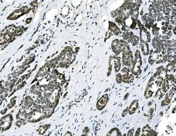 HOXD11 Antibody in Immunohistochemistry (Paraffin) (IHC (P))