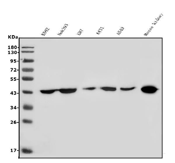 HOXD11 Antibody in Western Blot (WB)