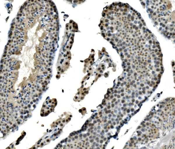 LSM8 Antibody in Immunohistochemistry (Paraffin) (IHC (P))