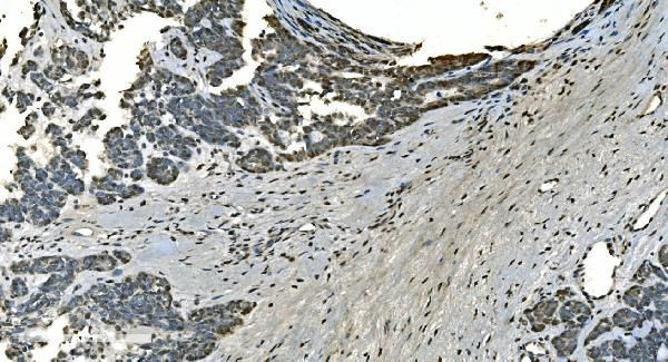 LSM8 Antibody in Immunohistochemistry (Paraffin) (IHC (P))