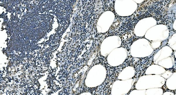 LSM8 Antibody in Immunohistochemistry (Paraffin) (IHC (P))