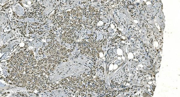 LSM8 Antibody in Immunohistochemistry (Paraffin) (IHC (P))