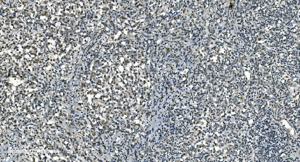 LSM8 Antibody in Immunohistochemistry (Paraffin) (IHC (P))