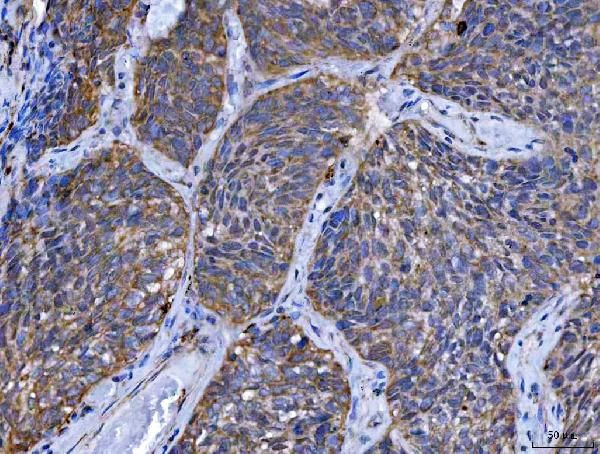 TMPRSS13 Antibody in Immunohistochemistry (Paraffin) (IHC (P))