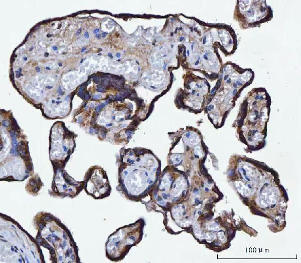 TMPRSS13 Antibody in Immunohistochemistry (Paraffin) (IHC (P))