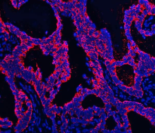 TMPRSS13 Antibody in Immunohistochemistry (Paraffin) (IHC (P))