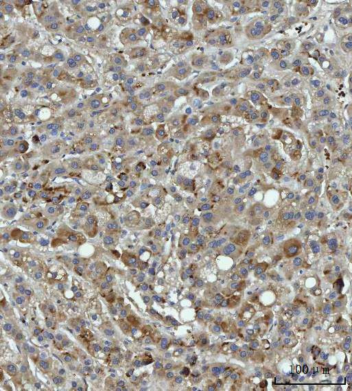 Thrombospondin 3 Antibody in Immunohistochemistry (Paraffin) (IHC (P))