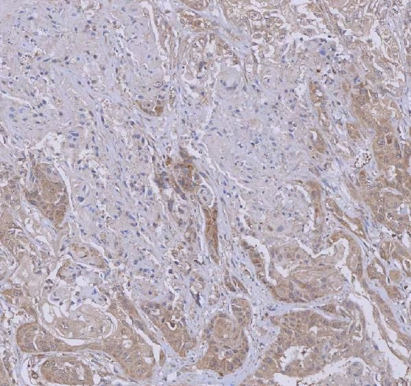 WDR44 Antibody in Immunohistochemistry (Paraffin) (IHC (P))