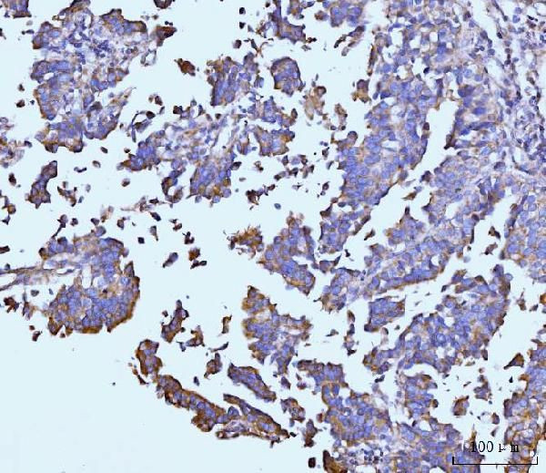 TARS2 Antibody in Immunohistochemistry (Paraffin) (IHC (P))