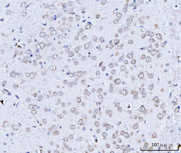 TARS2 Antibody in Immunohistochemistry (Paraffin) (IHC (P))