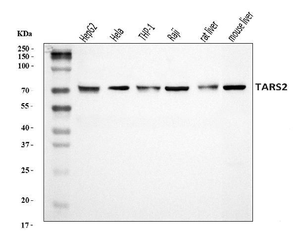 TARS2 Antibody in Western Blot (WB)