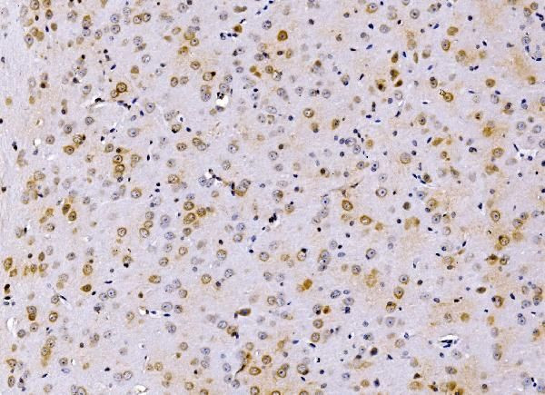 PSMD8 Antibody in Immunohistochemistry (Paraffin) (IHC (P))