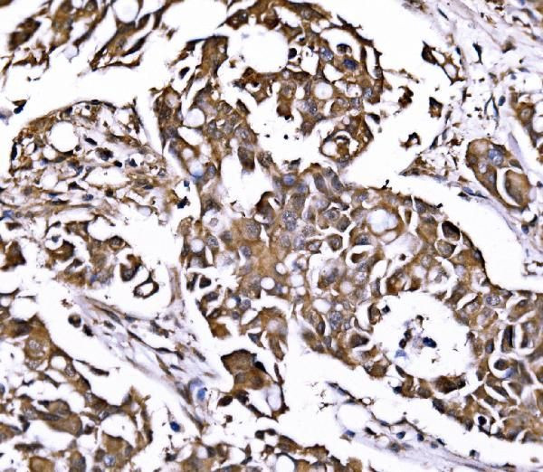 PSMD8 Antibody in Immunohistochemistry (Paraffin) (IHC (P))