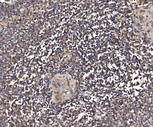 PSMD8 Antibody in Immunohistochemistry (Paraffin) (IHC (P))