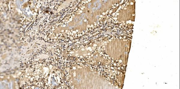 PSMD8 Antibody in Immunohistochemistry (Paraffin) (IHC (P))