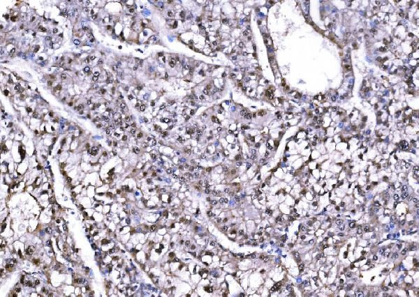 PSMD8 Antibody in Immunohistochemistry (Paraffin) (IHC (P))