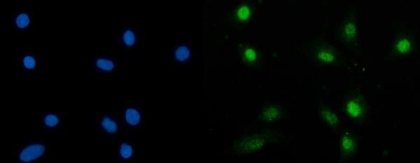 SBNO1 Antibody in Immunocytochemistry (ICC/IF)