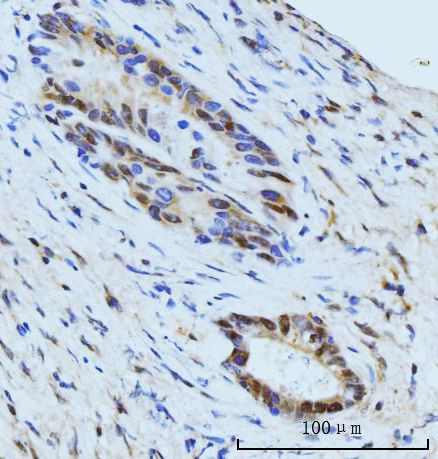 SBNO1 Antibody in Immunohistochemistry (Paraffin) (IHC (P))