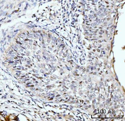 SBNO1 Antibody in Immunohistochemistry (Paraffin) (IHC (P))